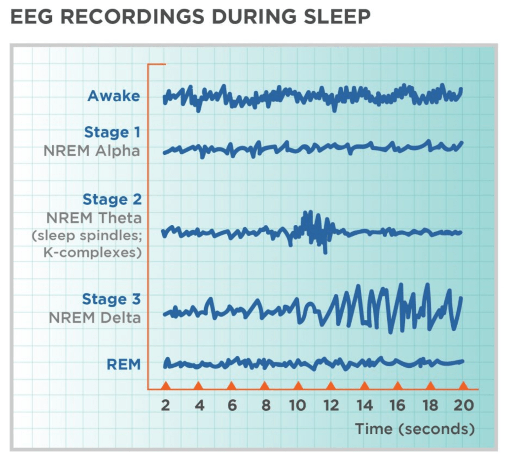 EEG Recordings During Sleep
